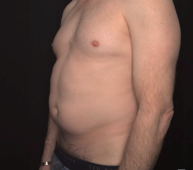 Before image