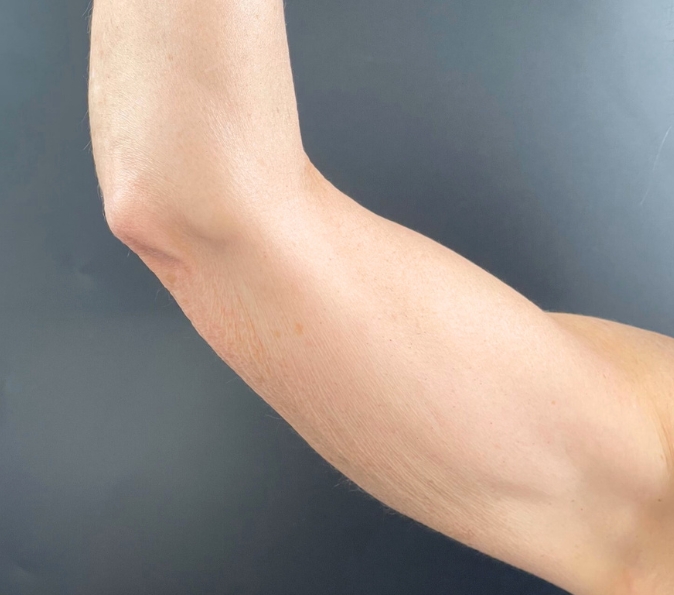 Before image
