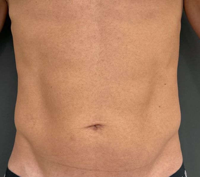 Before image