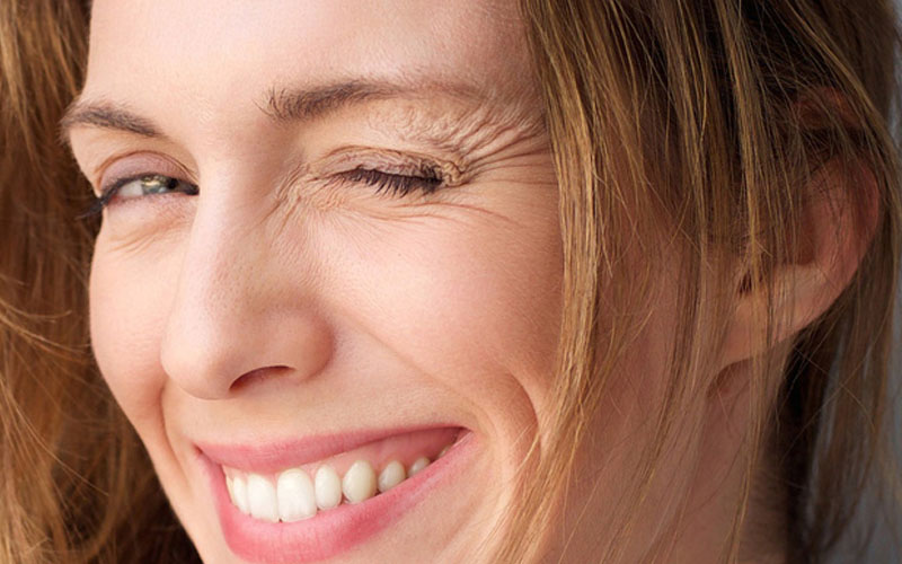 Nếp nhăn biểu cảm (Expression Wrinkles)