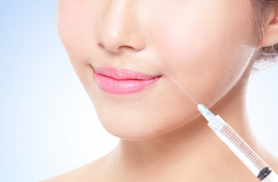 Tiêm filler – Làm đầy rãnh nhăn và vùng thiếu hụt thể tích