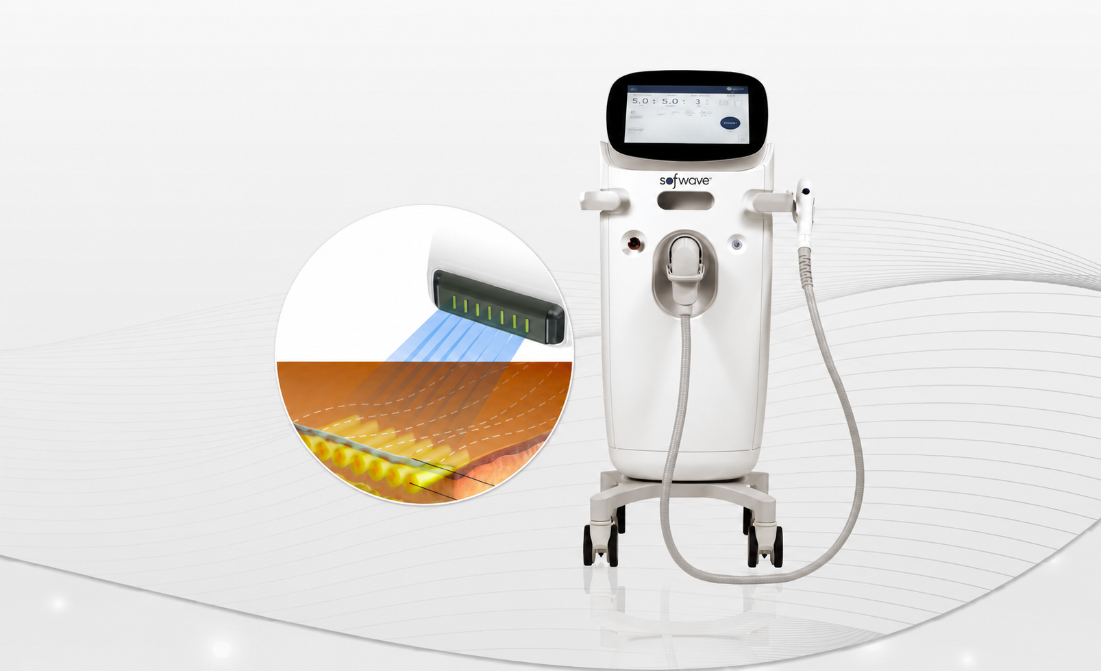 Cơ chế hoạt động của Sofwave