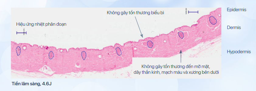 Nguồn: Virginia Benitez-Roig, MD
