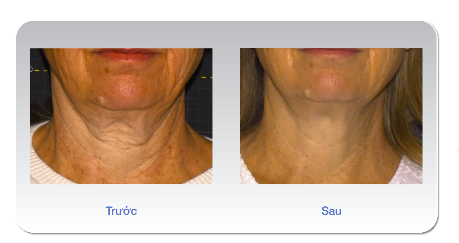 Nguồn: Bác sĩ Roy Suzanne Kilmer, MD