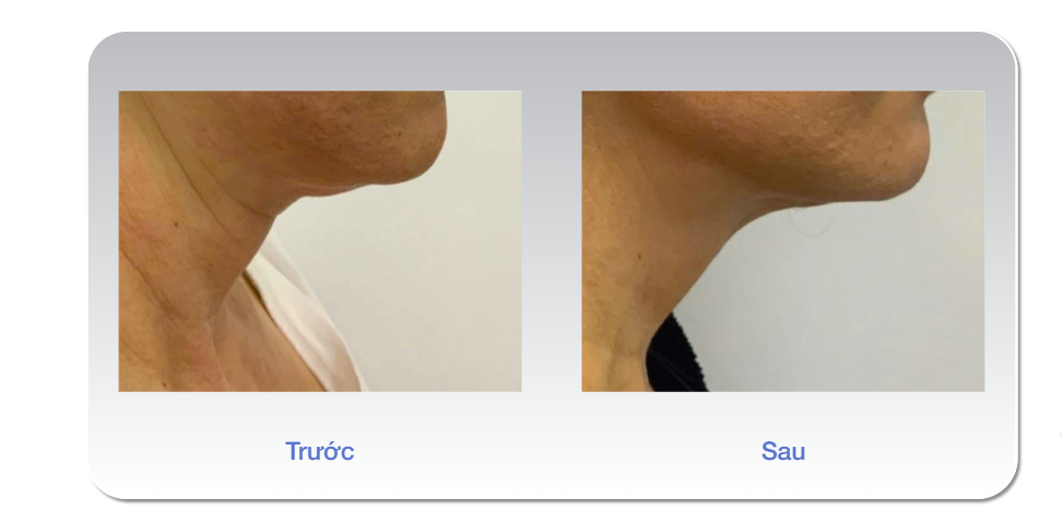 Nguồn: Bác sĩ Luis Lee, MD