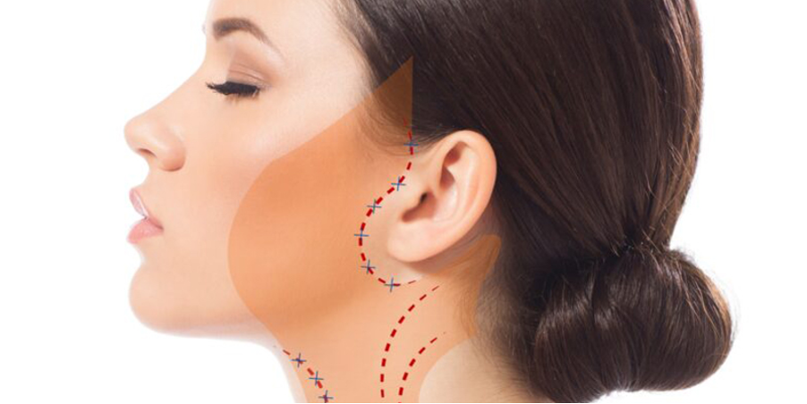 Hạn chế phẫu thuật lên da và thời gian nghỉ dưỡng