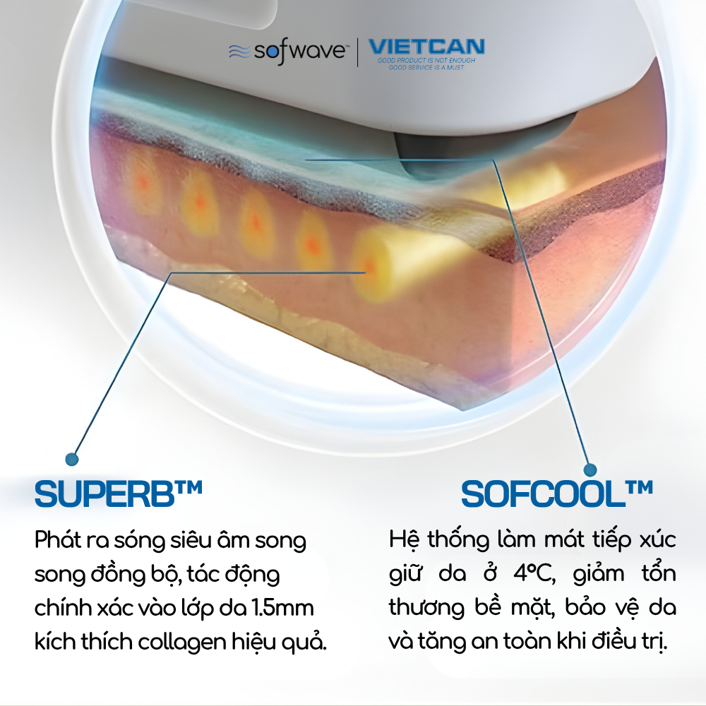 Công nghệ sóng siêu âm song song đồng bộ SUPERB™ có gì khác biệt?