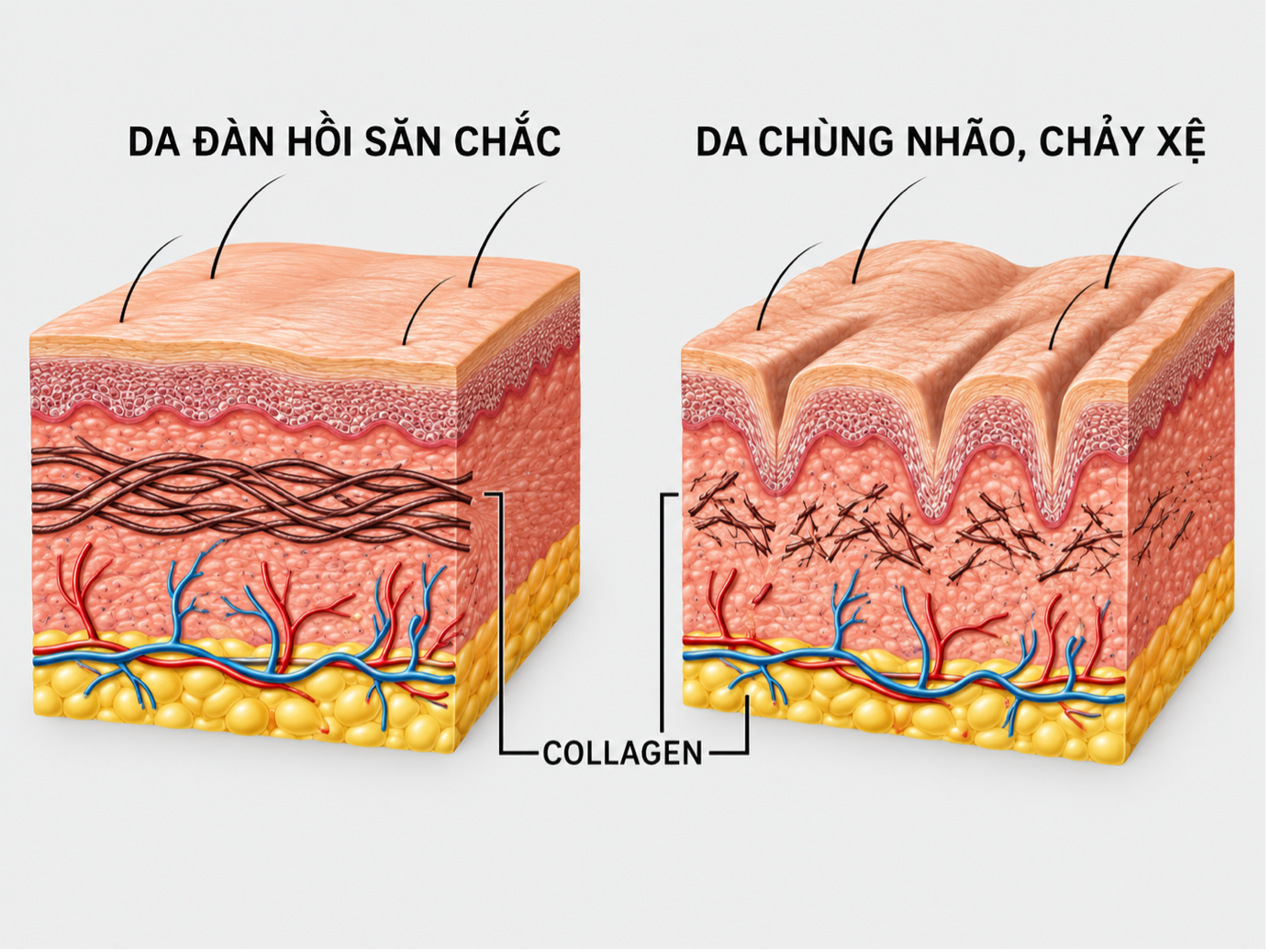Collagen tạo nên cấu trúc nâng đỡ của da