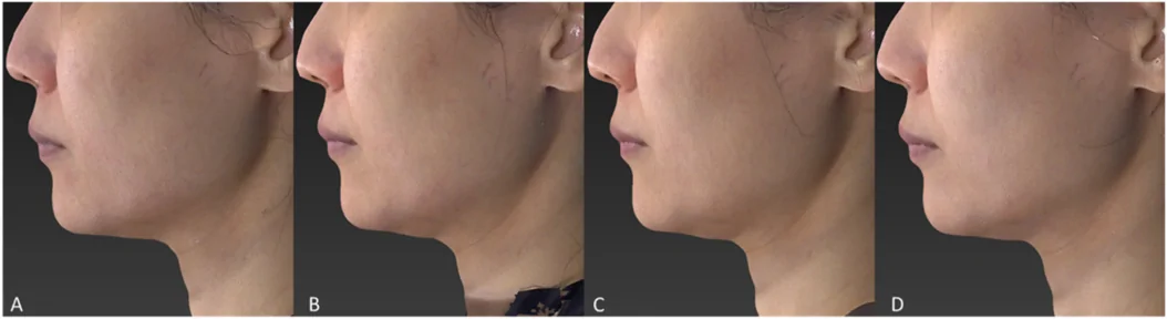 Ảnh tiêu chuẩn cho đối tượng đại diện 3